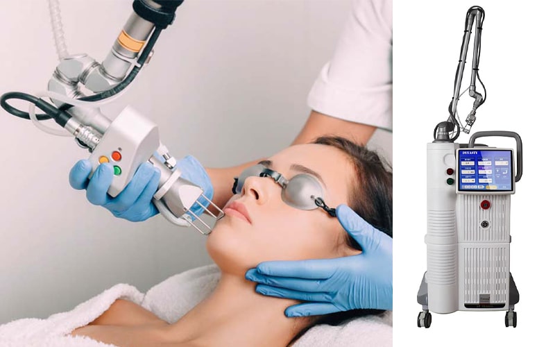 لیزر CO2 فرکشنال