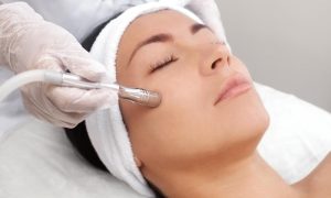 بهترین دستگاه میکرودرم ابریژن